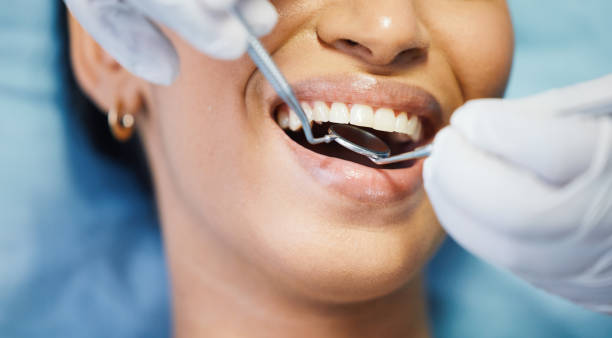 Best Emergency Care for Gum Disease in Montevideo, MN